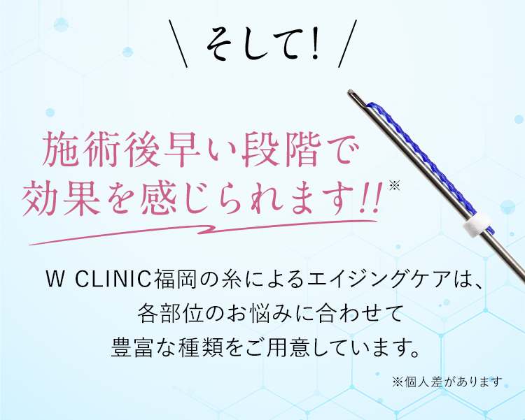 そして施術後早い段階で効果を感じられます！※個人差があります。W CLINIC福岡の糸による若返り治療は、各部位のお悩みに合わせて豊富な種類をご用意しています。