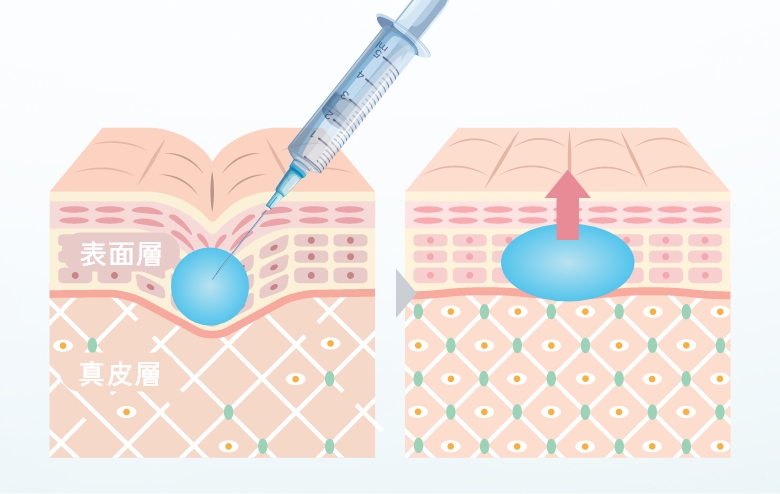 痛みの少ない施術ができる