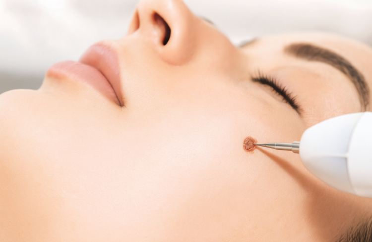 傷跡を最小限に抑える技術